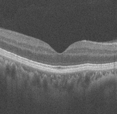 2D B-scan Slice